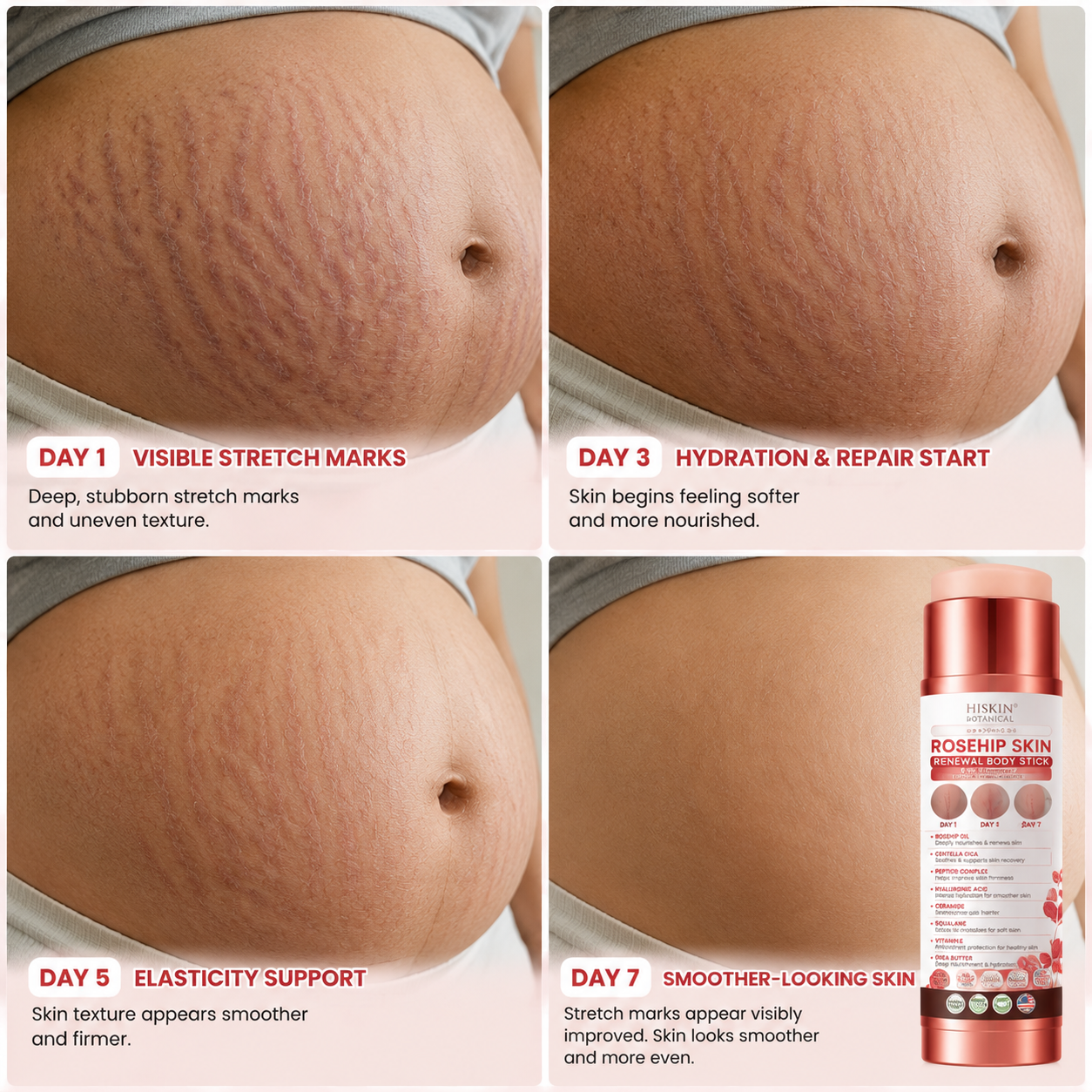 30𝐇𝐈𝐒𝐊𝐈𝐍® 7-Day Skin Transformation Body Stick Firming, Stretch Mark Smoothing & Skin Renewal Formula（副本）