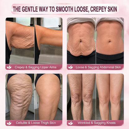 30𝐇𝐈𝐒𝐊𝐈𝐍® 7-Day Skin Transformation Body Stick Firming, Stretch Mark Smoothing & Skin Renewal Formula（副本）